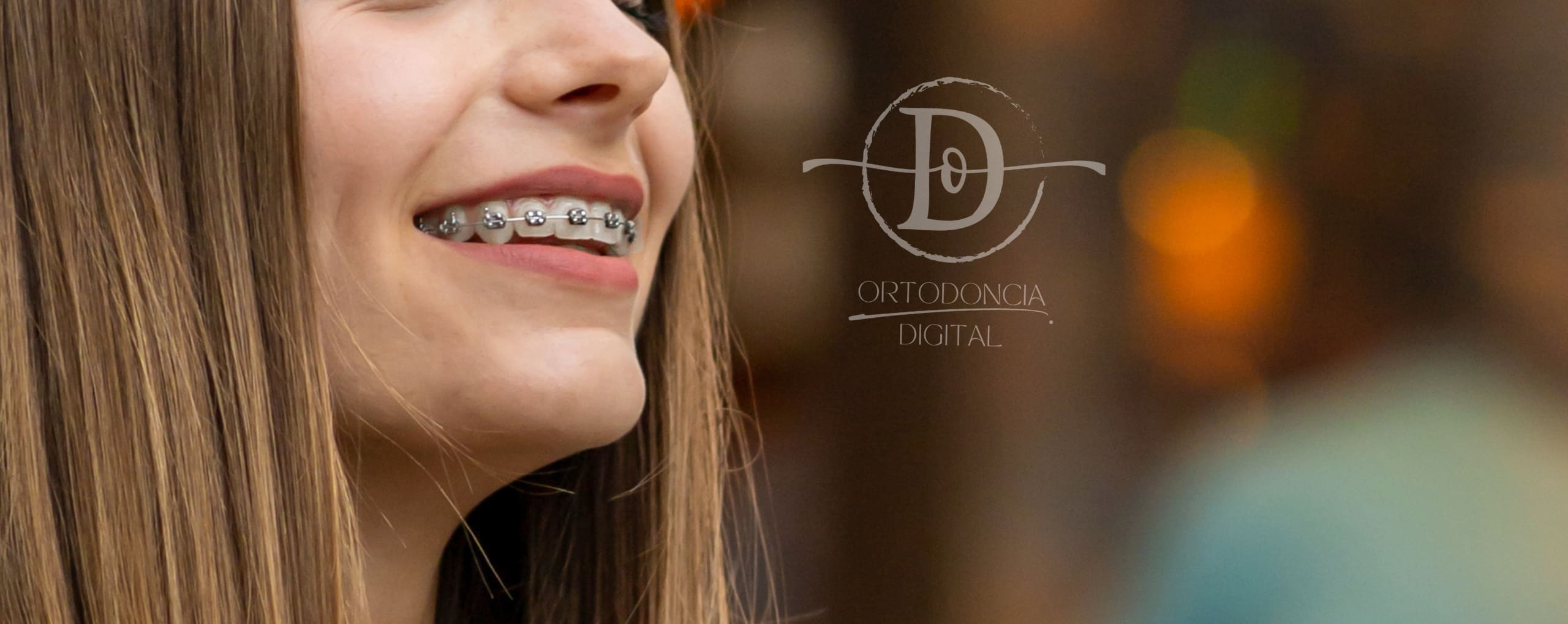 Ortodoncia con Brackets en las condes santiago